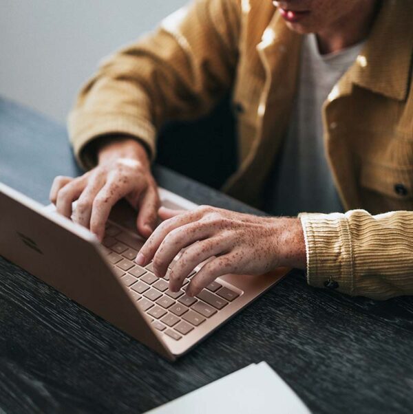 Customized software development